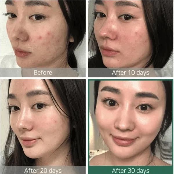 Some By Mi AHA BHA PHA 30 Days Miracle Toner (Rose), 150 мл — фото 6